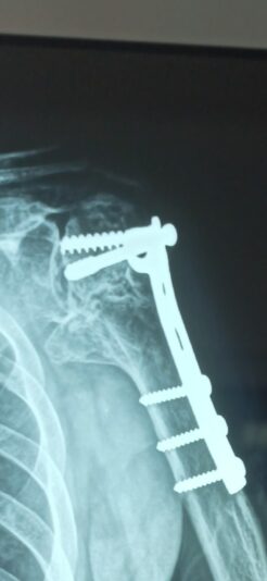 Screenshot_2025-07-27-18-12-42-629_com.miui.gallery